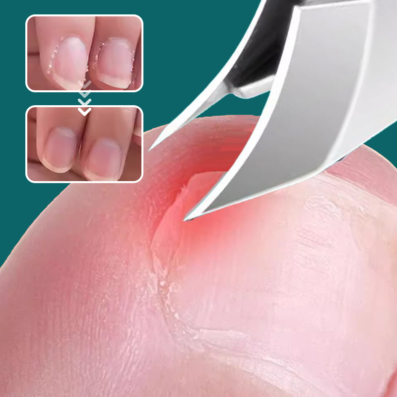 🔥💅 Комплект от 3 нокторезачки, оборудвани с 25° наклонена страна за предпазване от пръски